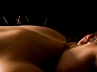 Acupuncture: the ancient medical wonder