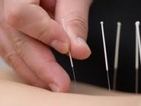 Substance Abuse and Acupuncture